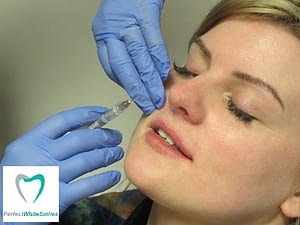 Lip Filler Dublin - treatment 2