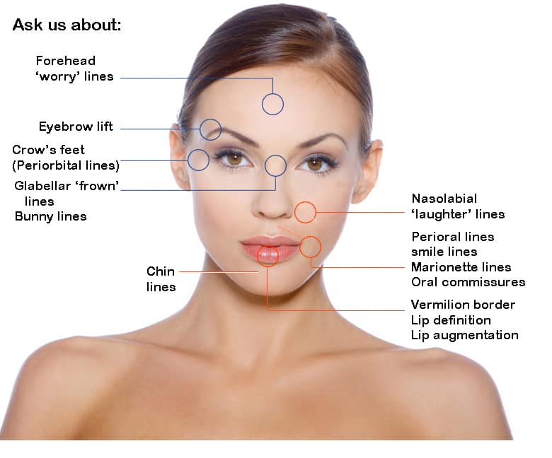 areas - botox fillers